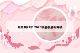 銀屑病22年 2020銀屑病最新突破
