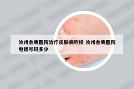 汝州金庚醫(yī)院治療皮膚病咋樣 汝州金庚醫(yī)院電話號(hào)碼多少
