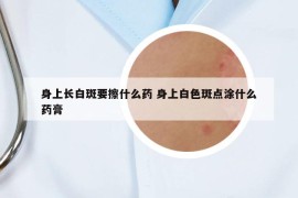身上長(zhǎng)白斑要擦什么藥 身上白色斑點(diǎn)涂什么藥膏