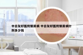 中日友好醫(yī)院銀屑病 中日友好醫(yī)院銀屑病針劑多少錢