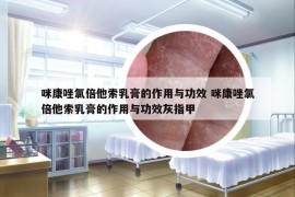 咪康唑氯倍他索乳膏的作用與功效 咪康唑氯倍他索乳膏的作用與功效灰指甲