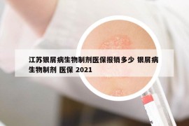 江蘇銀屑病生物制劑醫(yī)保報銷多少 銀屑病 生物制劑 醫(yī)保 2021