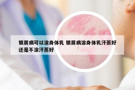 銀屑病可以涂身體乳 銀屑病涂身體乳汗蒸好還是不涂汗蒸好