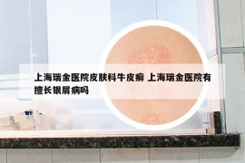 上海瑞金醫(yī)院皮膚科牛皮癬 上海瑞金醫(yī)院有擅長(zhǎng)銀屑病嗎