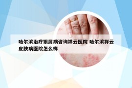 哈爾濱治療銀屑病咨詢祥云醫(yī)院 哈爾濱祥云皮膚病醫(yī)院怎么樣