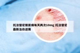 托法替尼銀屑病每天兩次10mg 托法替尼最新治白進展