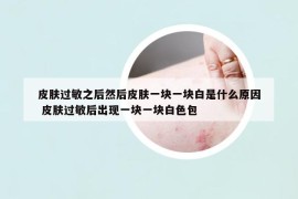 皮膚過(guò)敏之后然后皮膚一塊一塊白是什么原因 皮膚過(guò)敏后出現(xiàn)一塊一塊白色包
