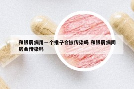 和銀屑病用一個推子會被傳染嗎 和銀屑病同房會傳染嗎