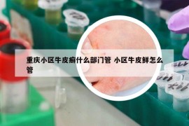 重慶小區(qū)牛皮癬什么部門管 小區(qū)牛皮鮮怎么管