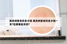 英夫利昔單抗多少錢 英夫利昔單抗多少錢一支?在那里能買到?