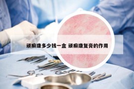 頑癬康多少錢一盒 頑癬康復(fù)膏的作用