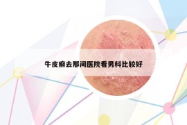 牛皮癬去那間醫(yī)院看男科比較好