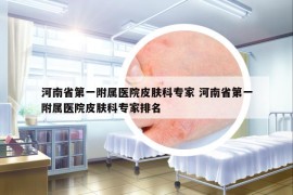 河南省第一附屬醫(yī)院皮膚科專家 河南省第一附屬醫(yī)院皮膚科專家排名