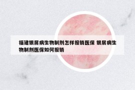 福建銀屑病生物制劑怎樣報(bào)銷(xiāo)醫(yī)保 銀屑病生物制劑醫(yī)保如何報(bào)銷(xiāo)