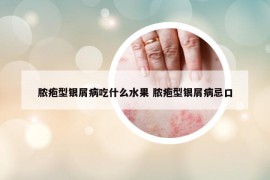 膿皰型銀屑病吃什么水果 膿皰型銀屑病忌口
