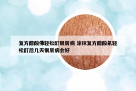 復方醋酸佛輕松酊銀屑病 涂抹復方醋酸氟輕松酊后幾天銀屑病會好
