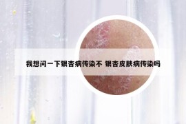 我想問一下銀杏病傳染不 銀杏皮膚病傳染嗎