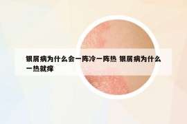 銀屑病為什么會(huì)一陣?yán)湟魂嚐?銀屑病為什么一熱就癢