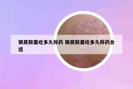 銀屑膠囊吃多久停藥 銀屑膠囊吃多久停藥合適