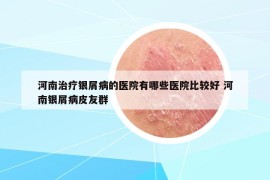 河南治療銀屑病的醫(yī)院有哪些醫(yī)院比較好 河南銀屑病皮友群