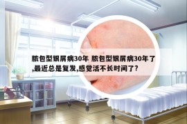 膿包型銀屑病30年 膿包型銀屑病30年了,最近總是復(fù)發(fā),感覺活不長時間了?