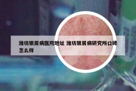 濰坊銀屑病醫(yī)院地址 濰坊銀屑病研究所口碑怎么樣
