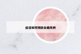應(yīng)該如何預(yù)防白癜風啊