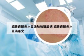 麻黃連軺赤小豆湯加味銀屑病 麻黃連軺赤小豆湯條文