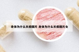 身體為什么長(zhǎng)癬圖片 身體為什么長(zhǎng)癬圖片女
