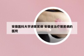 安徽醫(yī)科大學(xué)講銀屑病 安徽省治療銀屑病的醫(yī)院