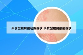 頭皮型銀屑病初期癥狀 頭皮型銀屑病的癥狀