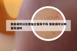 銀屑病可以吃黑加侖葡萄干嗎 銀屑病可以喝葡萄酒嗎