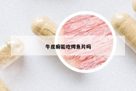 牛皮癬能吃烤魚片嗎