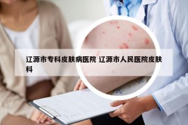 遼源市?？破つw病醫(yī)院 遼源市人民醫(yī)院皮膚科