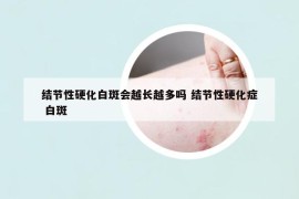 結(jié)節(jié)性硬化白斑會越長越多嗎 結(jié)節(jié)性硬化癥 白斑