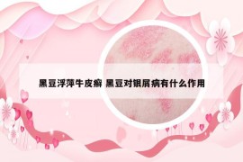 黑豆浮萍牛皮癬 黑豆對銀屑病有什么作用
