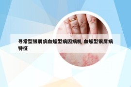 尋常型銀屑病血燥型病因病機(jī) 血燥型銀屑病特征