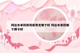 阿達(dá)木單抗和司庫奇尤哪個(gè)好 阿達(dá)木單抗哪個(gè)牌子好