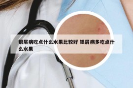 銀屑病吃點(diǎn)什么水果比較好 銀屑病多吃點(diǎn)什么水果