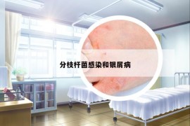 分枝桿菌感染和銀屑病