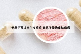 無患子可以治牛皮癬嗎 無患子能治皮膚病嗎