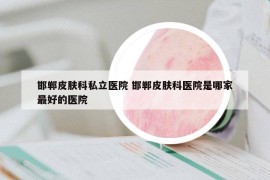 邯鄲皮膚科私立醫(yī)院 邯鄲皮膚科醫(yī)院是哪家最好的醫(yī)院