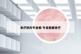 食療奶片牛皮癬 牛皮膚癬食療