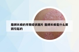 胳膊長(zhǎng)癬的早期癥狀圖片 胳膊長(zhǎng)癬是什么原因引起的