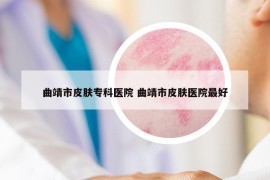 曲靖市皮膚專科醫(yī)院 曲靖市皮膚醫(yī)院最好