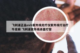 飛利浦正品uvb紫外線光療儀紫外線燈治療牛皮癬 飛利浦紫外線殺菌燈管