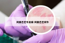 阿里巴巴牛皮癬 阿里巴巴阿牛