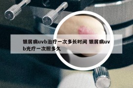 銀屑病uvb治療一次多長時間 銀屑病uvb光療一次照多久