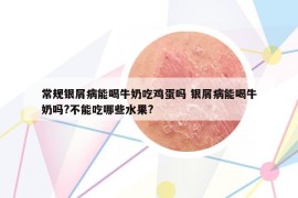 常規(guī)銀屑病能喝牛奶吃雞蛋嗎 銀屑病能喝牛奶嗎?不能吃哪些水果?