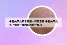 手肘關(guān)節(jié)處長(zhǎng)了像癬一樣的東西 手肘關(guān)節(jié)處長(zhǎng)了像癬一樣的東西用什么藥